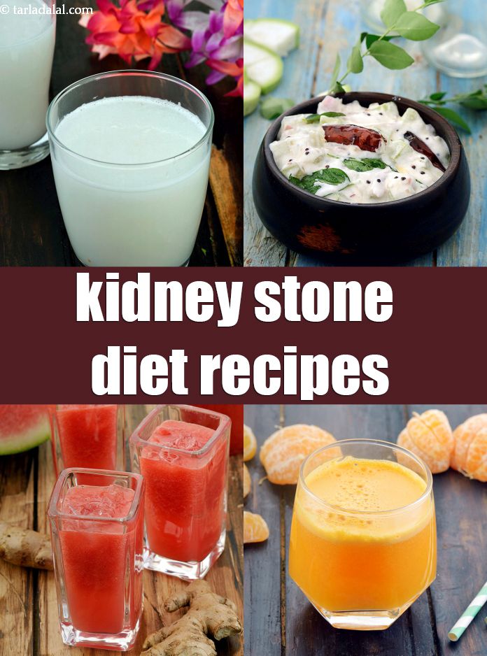 Kidney Stone Diet Chart